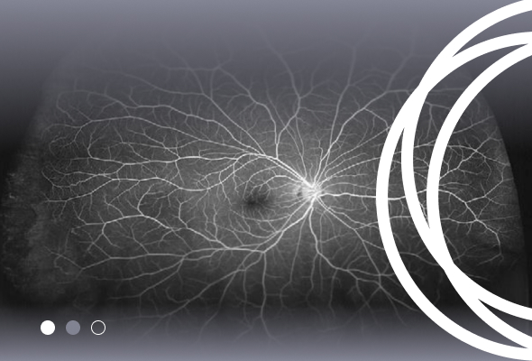 Angiografia retinal